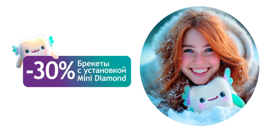 Брекеты Mini Diamond с установкой за 29 900 ₽